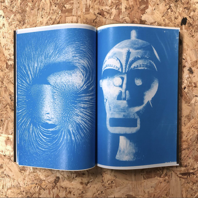 MRI Magnetic Resonance Imaging