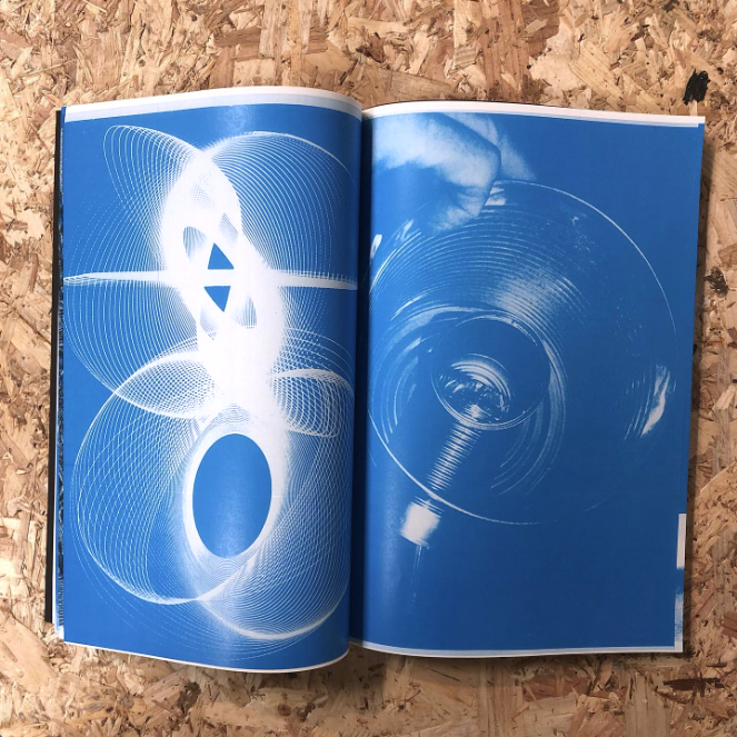 MRI Magnetic Resonance Imaging