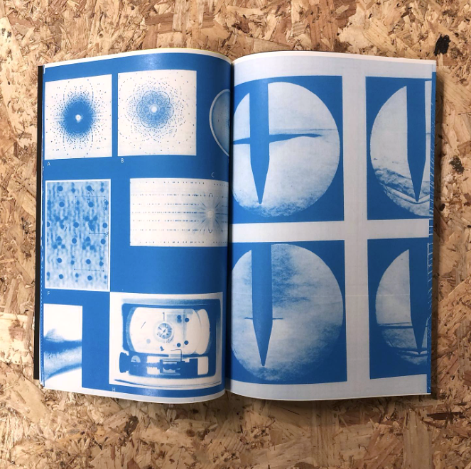 MRI Magnetic Resonance Imaging