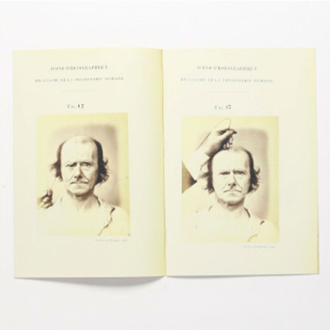 Specimen - photographic electrophysiology
