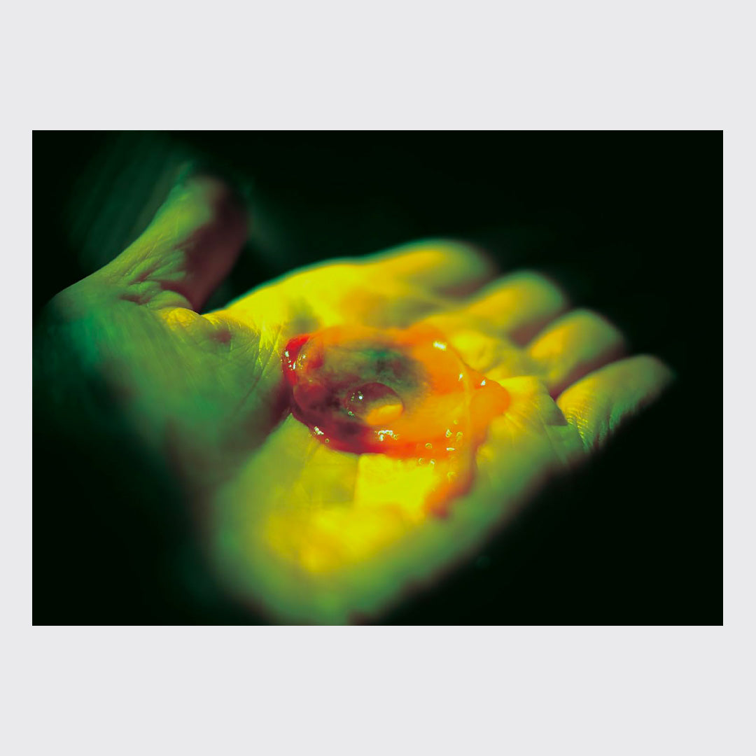 My Bloody Hand