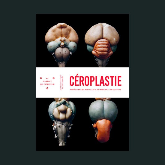 Céroplastie